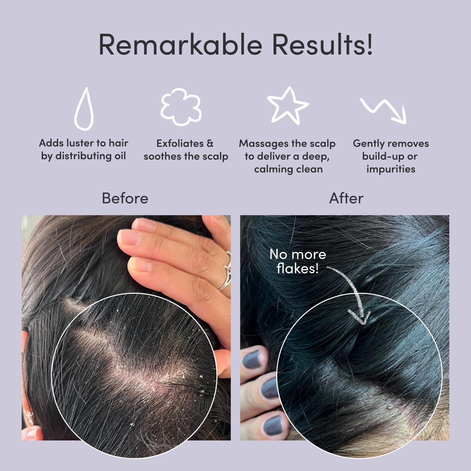 Exfoliator Brush Scalp – Dandruff &amp; Build-Up Remover