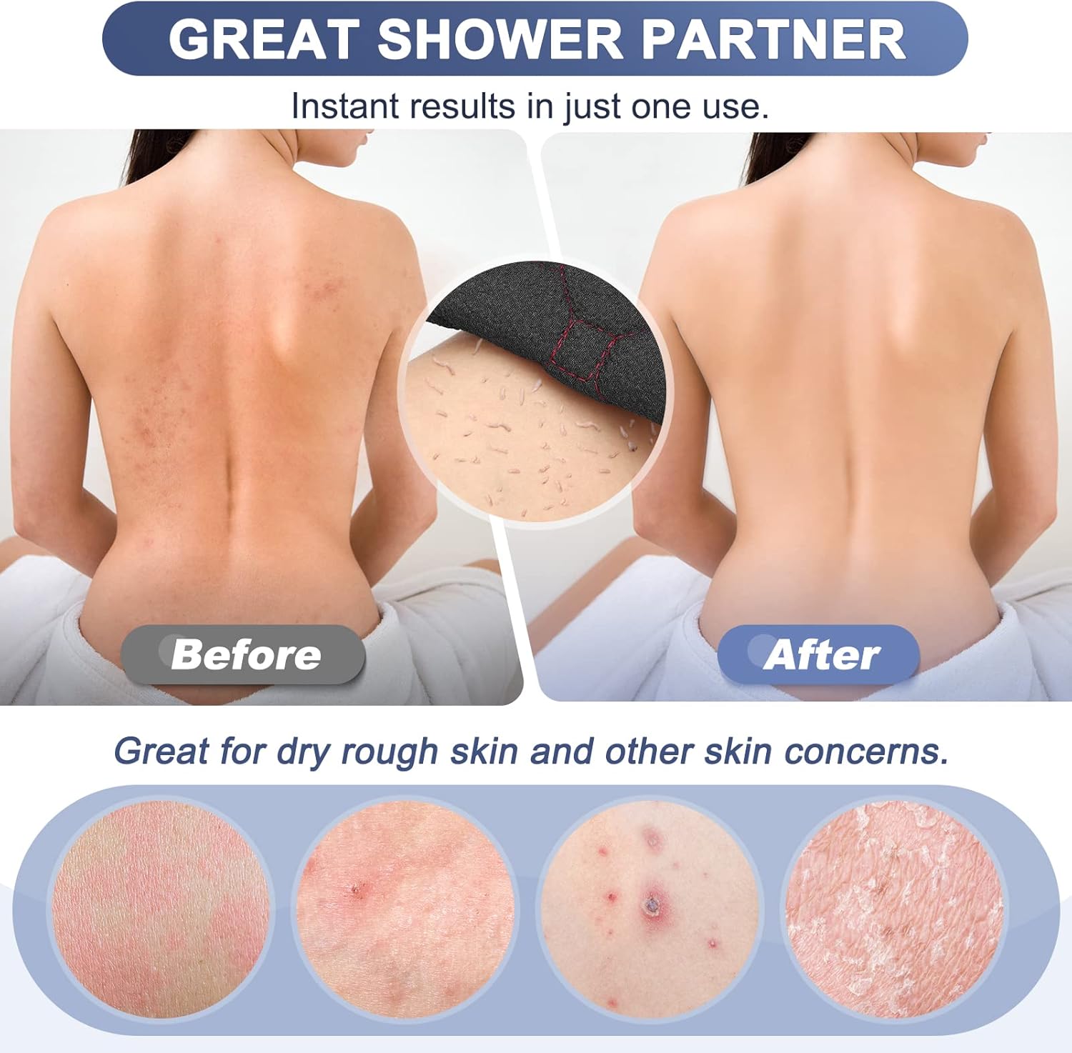 Exfoliating Back Scrubber – Double-Sided Shower